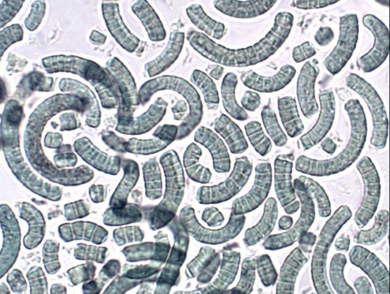 Spirulina onder de lichtmicroscoop, 400 keer vergroot Spirulina, 400 keer vergroot